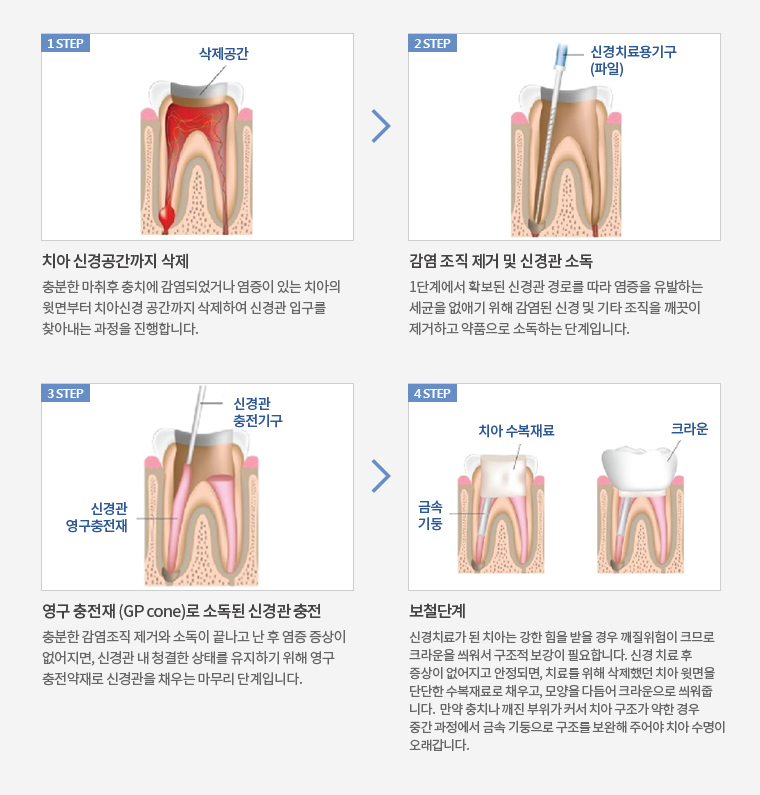 치료과정
